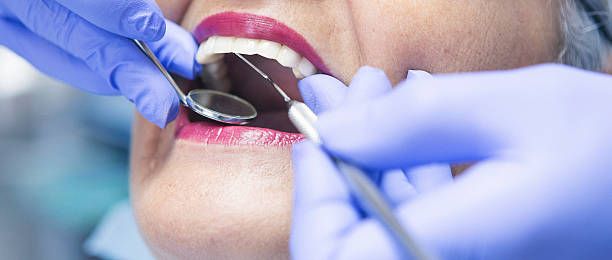 Best Emergency Dental Filling Replacement  in Wolf Creek, UT